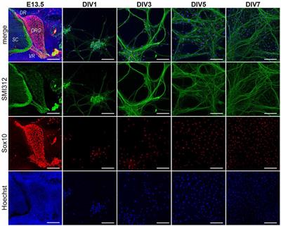 Retracing Schwann Cell Developmental Transitions in Embryonic Dissociated DRG/Schwann Cell Cocultures in Mice